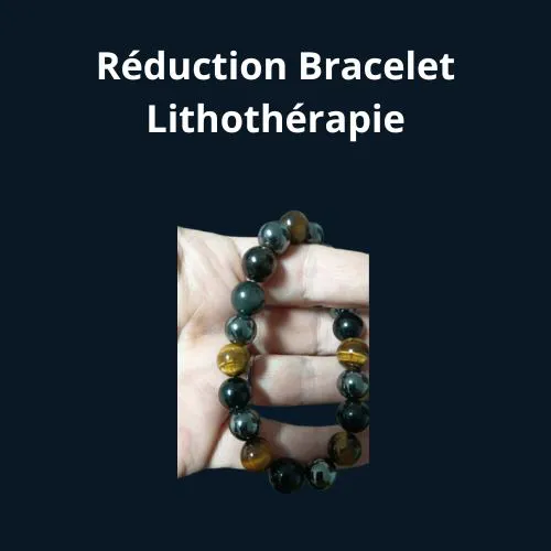  R&eacute;duction Bracelet classic